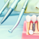 Zahnarztutensilien mit Querschnitt eines Zahnmodells